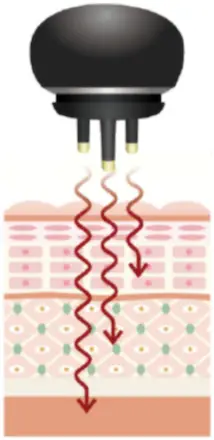 美顔機能➁表皮・真皮・皮下組織の細胞を活性化させるマイクロカレント