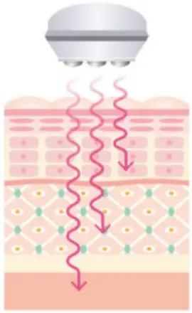 セルキュア4tプラス 美顔機能➁表皮・真皮・皮下組織の細胞を活性化させるマイクロカレント