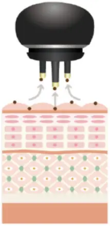 美顔機能①毛穴・皮溝レベルまで洗浄するエレクトロクレンジング