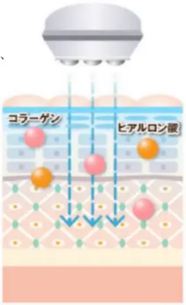 セルキュア4tプラス 美顔機能④肌に効果的な栄養補給を行うディーポレーション