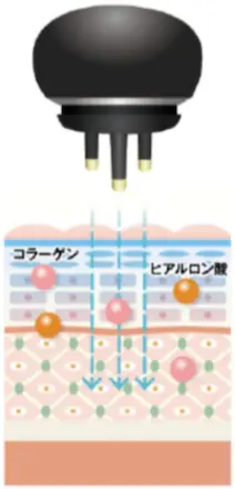 美顔機能④肌に効果的な栄養補給を行うディーポレーション